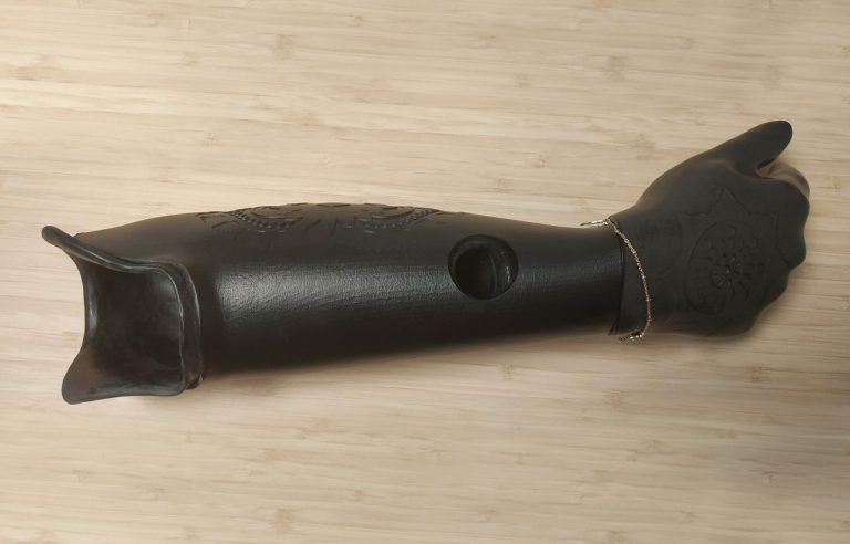 Building Image Recognition systems for people with prosthetics